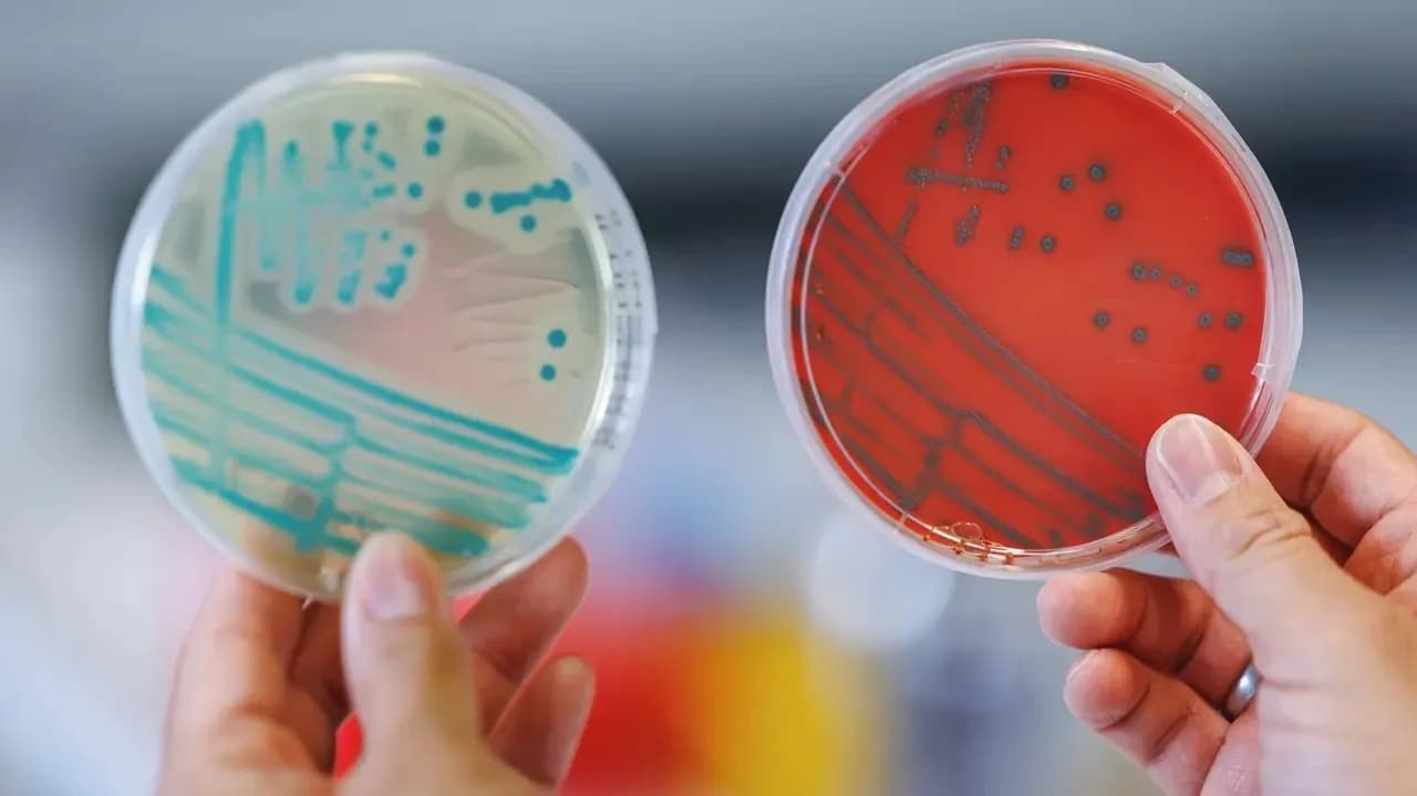 Thu hồi salad Vlašský từ Klatovy do nhiễm khuẩn Listeria